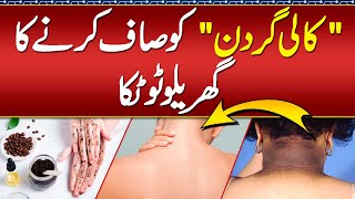 Kali Gardan Kaise Saaf Karen  Acanthosis Nigricans Home Remedies  Black Elbow amp Black Knee Removal [upl. by Jerri]