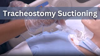 Tracheostomy Suctioning [upl. by Armillda]