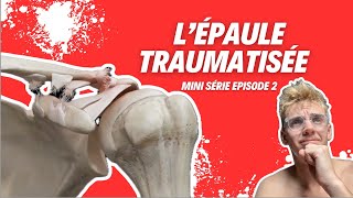 LÉPAULE TRAUMATIQUE  fractures luxations et rééducation 💪 [upl. by Olracnaig]