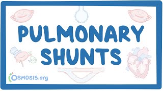 Pulmonary shunts [upl. by Linker]