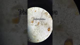 Trichuris trichiura biología science musica [upl. by Eiffe809]