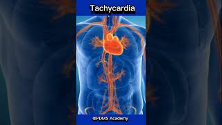 Tachycardia  Fast Heart rate  symptoms and causes medicine [upl. by Silvestro]