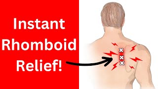 Fix Rhomboid Pain  With 2 Exercises [upl. by Nylkoorb]