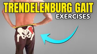 3 Exercises to Correct a Trendelenburg Gait Pattern [upl. by Caty]