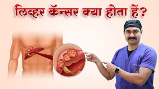 क्या Liver Cancer को ठीक कर सकते है Liver Cancer Treatment  DrBipin Vibhute  Hindi [upl. by Maharva]