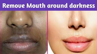 How To Remove Dark Black Patches Dark Spots Hyper Pigmentation Around Your MouthNibedita Mishra [upl. by Phip]