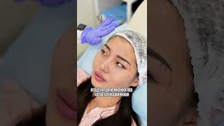 Процедура ботокс Full Face✨ dostykmed косметолог beauty омоложениелица [upl. by Nolava]