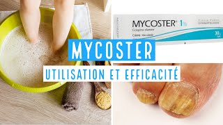 MYCOSTER Ciclopirox 1  8 [upl. by Ainaznat]