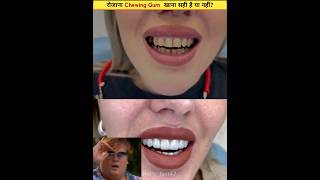 रोजाना Chewing Gum खाना सही है या नहींshorts facts [upl. by Ailaza]