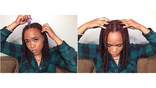 HOW TO GET RID OF ITCHY SCALP WITH LOCS [upl. by Oiraved]