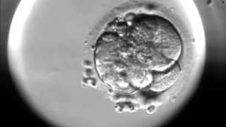 Timelapse of fertilisation of a human egg under the microscope [upl. by Atinal369]