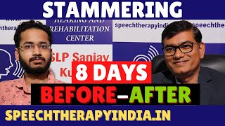 BeforeAfter  Stammering Speech Therapy Within 8 Days  By slpsanjaykumar  AIIMS Delhi Alumnus [upl. by Kiehl]