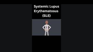 Systemic Lupus Erythematosus SLE [upl. by Plank]