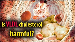 Is VLDL cholesterol harmful  Natural Health [upl. by Tanitansy967]