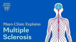 Mayo Clinic Explains Multiple Sclerosis [upl. by Vinson]