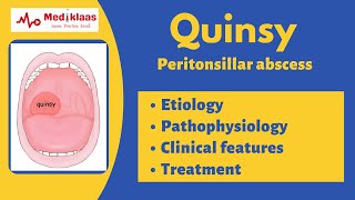 PERITONSILLAR ABSCESS [upl. by Amla808]