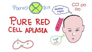 Pure Red Cell Aplasia PRCA  Parvo B19 Virus  Hematology [upl. by Cataldo524]