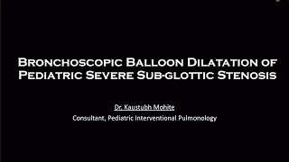 Bronchoscopic Balloon Dilatation in Post intubation Severe Subglottic Stenosis in childhood [upl. by Loziram]