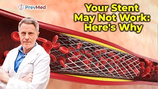 Your Stent May Not Work Heres Why [upl. by La Verne239]