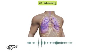 Abnormal lung sounds in COPD [upl. by Naziaf752]