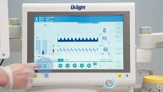 Lowflow anaesthesia for lung protective ventilation with Atlan anaesthesia workstations [upl. by Garrison]