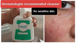 episoft cleansing lotion review in Tamil sensitiveskin [upl. by Vaenfila954]