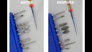 LAVADORA ULTRASONICA EN ODONTOLOGIA [upl. by Nosimaj]