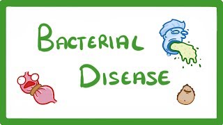 GCSE Biology  What Are Bacterial Diseases  Treatment and Prevention 37 [upl. by Yroj]