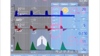 InspiratoryExpiratory Time Ratio IE [upl. by Arnaud]