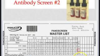 Practical Transfusion Medicine Part 1  Blood Typing Antibody Screen and Crossmatch [upl. by Ahsilav]