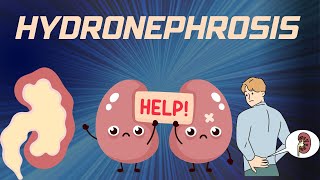 HYDRONEPHROSIS  Pathophysiology Causes signs and symptoms background diagnosis and treatment [upl. by Enad]