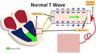 NORMAL T WAVE IN LIMB AND CHEST LEADS quotNORMAL ECG VALUESquot  NARCOSIS😴🤤 [upl. by Nylesor]