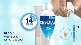 How To Remove Skin Tags With Cryotag Skin Tag Removal [upl. by Belia]