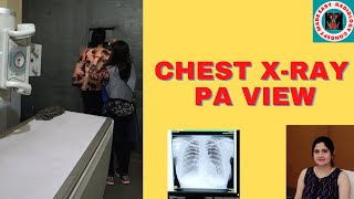 Xray Chest PA View l CXR PA VIEW I Anatomy l Patient Positioning l Radiography l Radiology l Xrays [upl. by Anrym376]