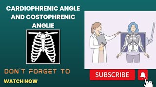 costophrenic and cardiophrenic angle and lungs zone [upl. by Arvad]