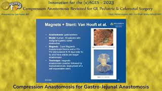 Compression Anastomosis for GastroJejunal Anastomosis [upl. by Duyne]