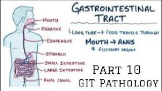 GIT Pathology Esophagus eosinophilic esophagitis and Barrett oesophagus [upl. by Pappano]