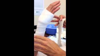 How To Apply A Short Arm Splint [upl. by Parthenia936]