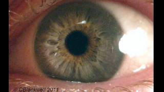 Eye Works 1 Focusing Cornea Iris and Lens [upl. by Itsirhc]