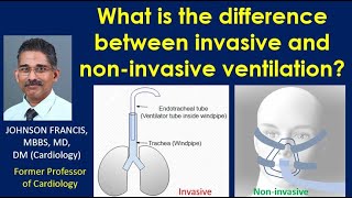 What is the difference between invasive and non invasive ventilation [upl. by Wash]