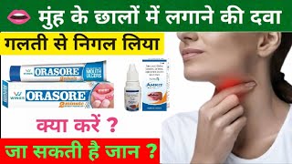 गलती से छाले की दवा निगलने से क्या होगा Chhale ki Gel Nigal Li Ab kya kre Orasore GelMouth Ulcer [upl. by Lanaj]