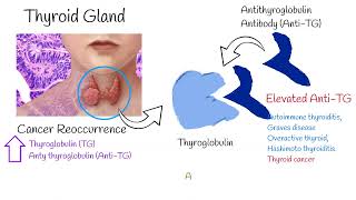 Thyroglobulin and Antithyroglobulin explained easy TG and Anti Tg TgAb tests [upl. by Eromle762]