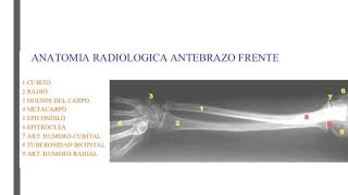 RX ANTEBRAZO [upl. by Thurmond]