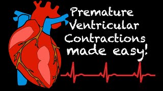 EMS Cardiology  Tachy Tuesday Premature Ventricular Contractions PVC [upl. by Latton]