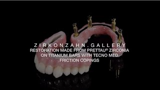 Restoration made from Prettau® Zirconia on Titanium bars with Tecno Med [upl. by Almallah]