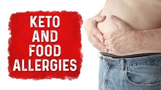 Food Allergies VS Digestion Issues on Keto Diet – DrBerg [upl. by Witty739]