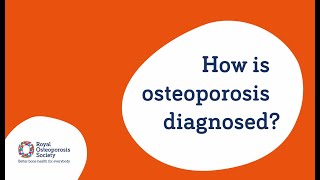 How is osteoporosis diagnosed [upl. by Rednave]