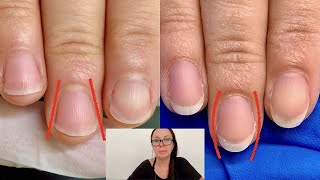 How I shaped these nails from fanning out to oval Nail technician explains [upl. by Kennan]