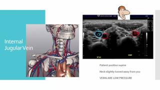 Vein Mapping Part 1 [upl. by Akirdnas567]