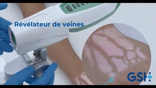 Révélateur de veines  Veincas  V800F [upl. by Enelie]